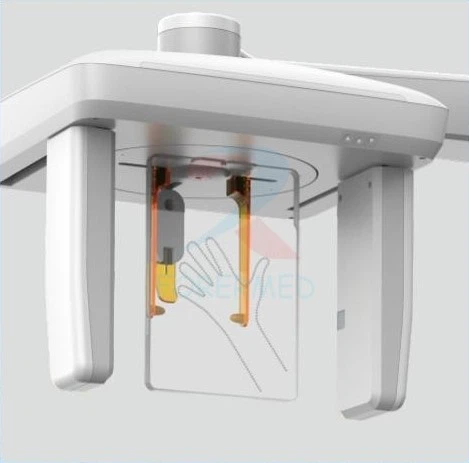 cbct scan for dental implants cbct scan for dental implants