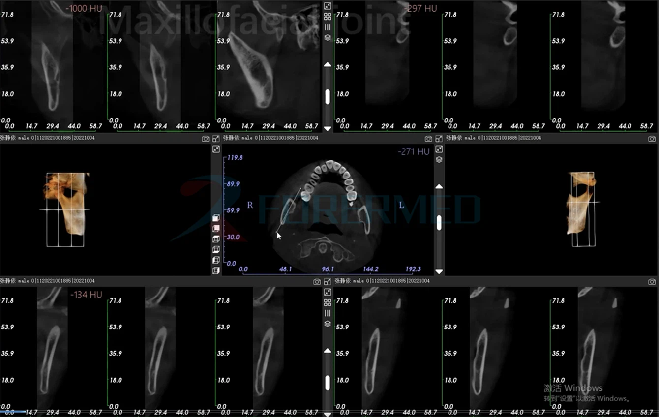 clinical image 5 clinical image 5