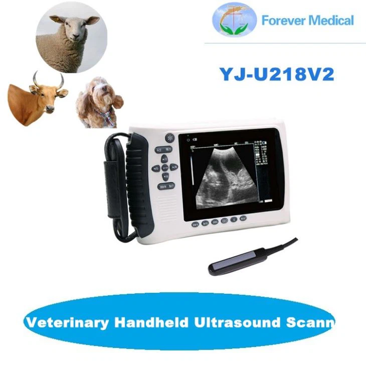 Handheld Ultrasound Scanner