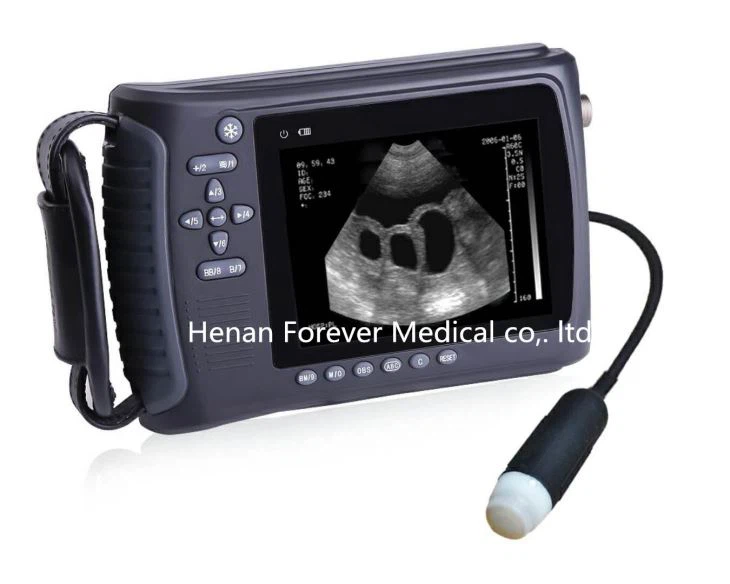 Handheld Ultrasound Scanner