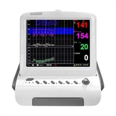 Monitor Doppler y Ffetws