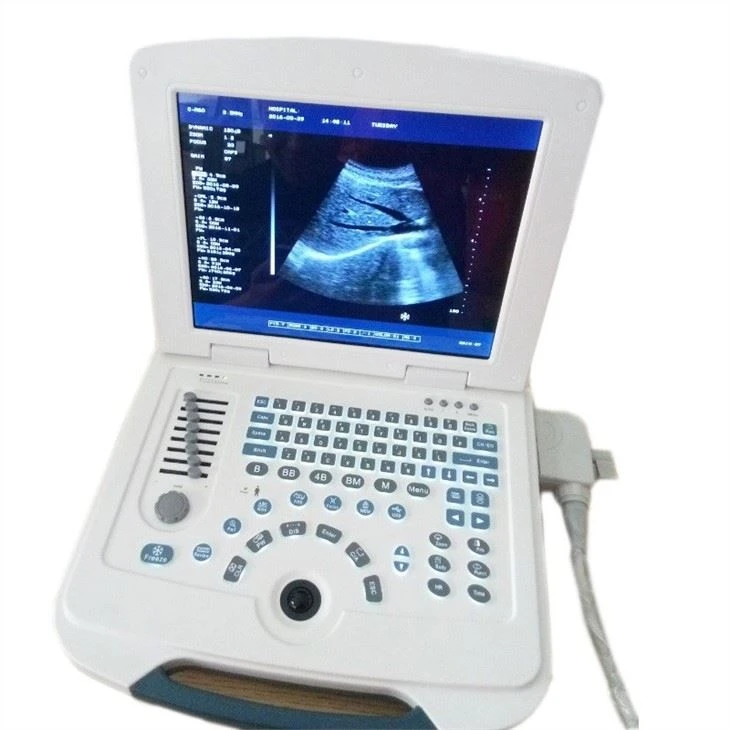 Version Full-Digital Laptop Ultrasound Scanner